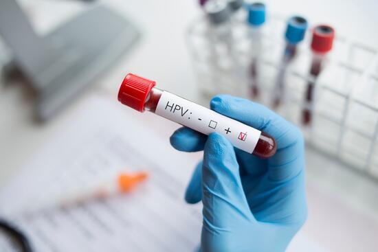 Stretla sa s ním väčšina ľudí, ochorie minimum: Tak prečo je nebezpečný? Strašiak s menom HPV