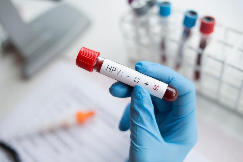 Stretla sa s ním väčšina ľudí, ochorie minimum: Tak prečo je nebezpečný? Strašiak s menom HPV