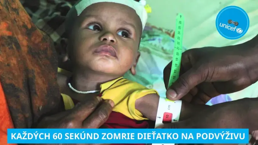 Jubilejný 20. ročník zbierky Modrý gombík UNICEF priniesol rekordnú pomoc: Slováci zachránili 4 345 detí, ktoré trpia podvýživou