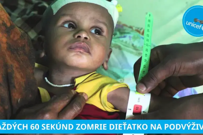 Jubilejný 20. ročník zbierky Modrý gombík UNICEF priniesol rekordnú pomoc: Slováci zachránili 4 345 detí, ktoré trpia podvýživou